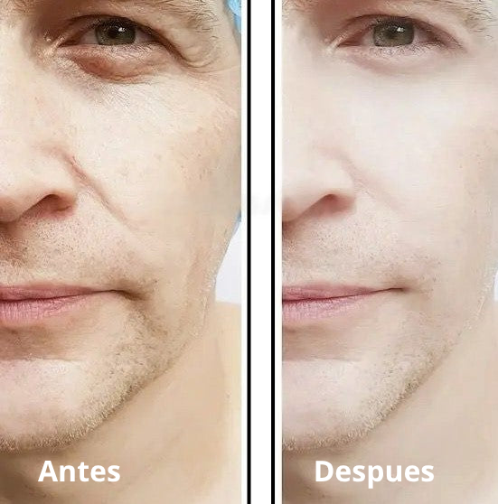2X1 EN CREMA EELHOE PARA HOMBRES