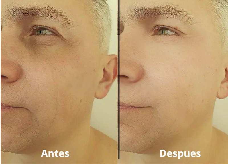 2X1 EN CREMA EELHOE PARA HOMBRES