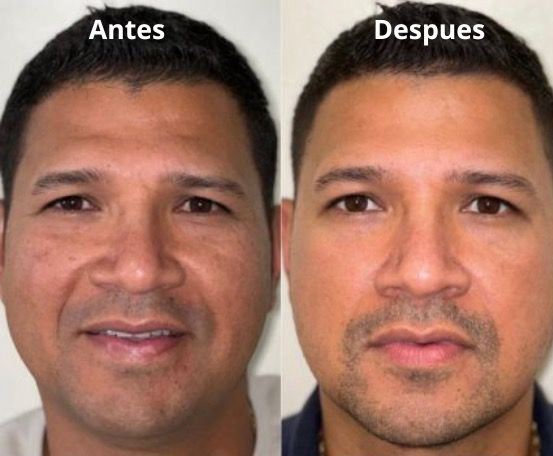 2X1 EN CREMA EELHOE PARA HOMBRES