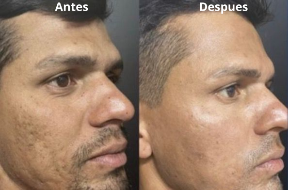 2X1 EN CREMA EELHOE PARA HOMBRES